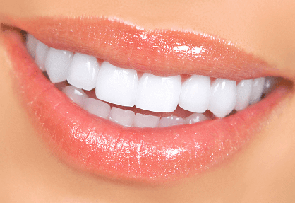 Bollywood Smile (Full Smile Makeover) in India