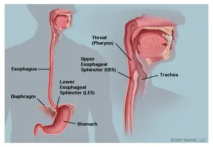 Esophageal (Food Pipe) Surgery in India