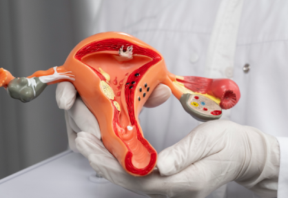 Hysterectomy Uterus Removal Surgery in India