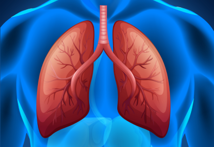 Lung Transplant in India