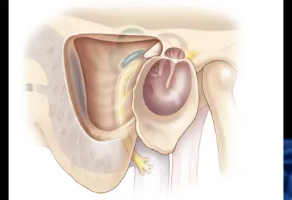 Mastoidectomy in India
