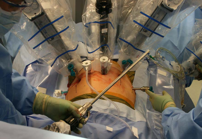 Robotic Prostate Surgery (RARP)